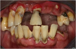 Teeth 2.jpg